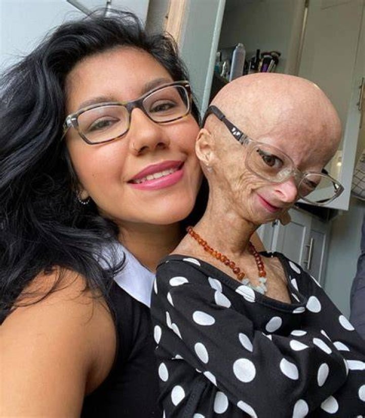 Adalia Rose Age, Family, Boyfriend, Net Worth,Height & More