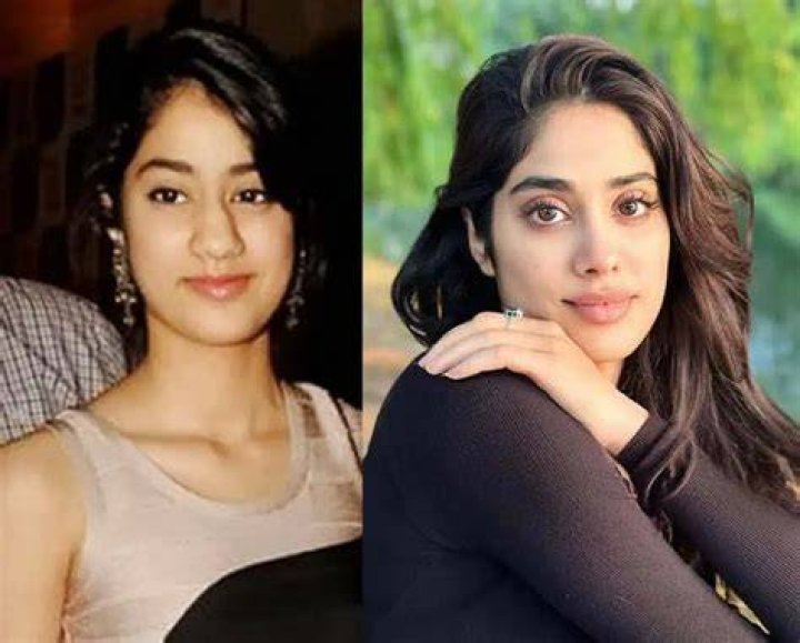 janhvi kapoor plastic surgery Latest News, Photos & Videos on janhvi