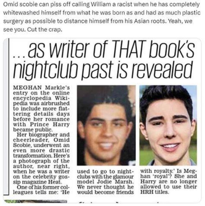 Omid Scobie Before And After Plastic Surgery Photos