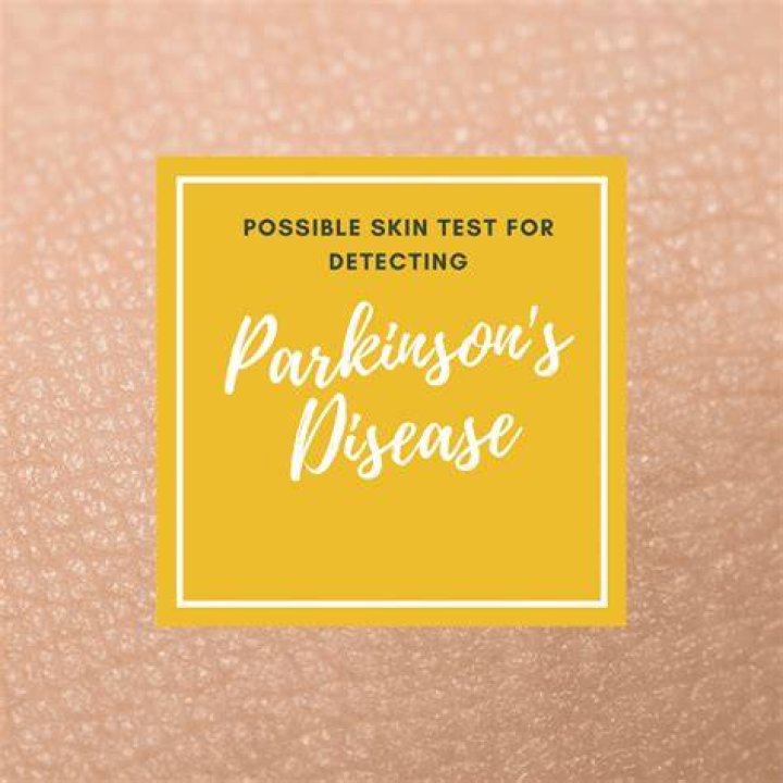 Possible Skin Test for Detecting Parkinson's Disease Premier