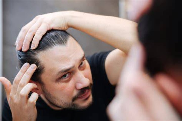 Santos Hair Loss, Health And Net Worth Explored