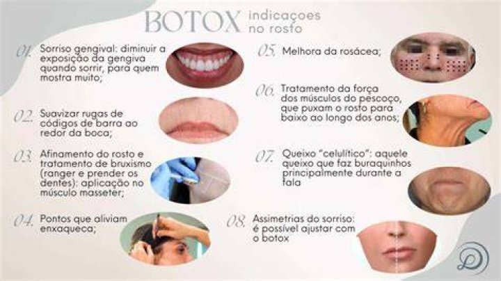 What To Do When Botox Goes Wrong According To Dr. Busso